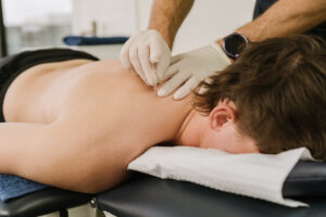 Physio performing Dry Needling to ease muscle pain and tightness